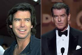 Veja como é o resultado desse procedimento: O Que E Bichectomia Alexandre Taleb