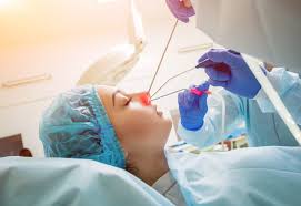 Nasal polyps may form anywhere in your sinuses or nasal passages, but they appear most often in an area where sinuses near your eyes, nose, and. When Do You Need Surgery For Nasal Polyps