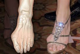 Celebrities With Hammer Toes Crooked Fingers And Deformities Clothes On You Hammer Toe Best Shoes For Bunions Bunion