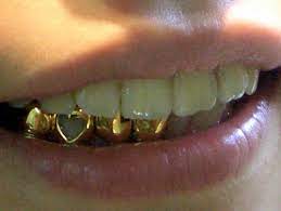 Pin By Alessandra Babz On The Beginning Grillz Girl Grillz Teeth Jewelry
