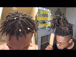Sep 07, 2020 · another one of the tips on how to make dreadlocks grow faster is to make sure that you are brushing your hair regularly. High Top Dread Update 32 Months How To Grow Dreads Fast Youtube