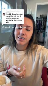 C-Section Incision Types and Recovery Explained