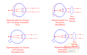 Goz Kusurlari