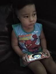 Bagaimana dan dimana rasa sakit itu terjadi tergantung pada penyebabnya. Alami Goldenhar Syndrom Rayqal Tiada Lubang Cuping Telinga Kanan Senyuman Tangisan Senget Ke Kiri Pa Ma