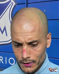 David González despues de la derrota de Millonarios frente al Cali