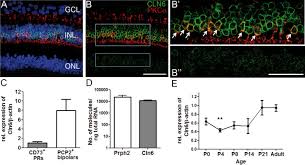 Ugg® morgan bath accessory collection. Prevention Of Photoreceptor Cell Loss In A Cln6nclf Mouse Model Of Batten Disease Requires Cln6 Gene Transfer To Bipolar Cells Molecular Therapy