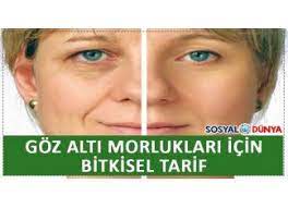 Goz Alti Morluklari Icin Bitkisel Tarifler Bitkisel Tarifler Videolar Gozler