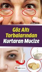 How To Get Rid Of Face Brown Spots In 2020 Baggy Eyes Under Eye Bags Eye Bags