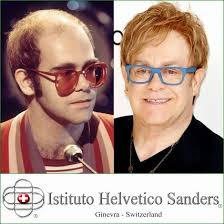 Calciatori · conduttori · attori. Elton John Prima E Dopo Il Trapiantocapelli Gallerie Fotografiche Fotografia Celebrita