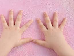 Medicated plasters, creams, paints and gels are often sufficient treatment to cryotherapy comes with a few possible side effects: Common Warts Craig Singer Md Dermatology