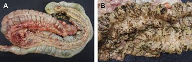 Image result for Rhodococcus equi