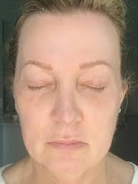 Highly Recommend Dr. Cameron Chestnut and Staff