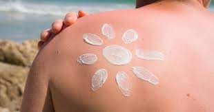 Ähnliche einträge in anderen lexika. Sonnenbrand Bei Kindern Behandlung Und Tipps Kanyo