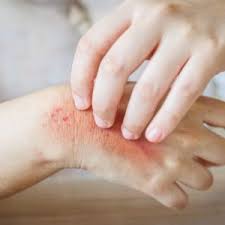 Image result for Hand Infection
