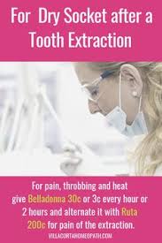 Here are 7 tips on how to avoid dry socket and keep your mouth healthy while recovering from a tooth extraction. Dry Socket Relief