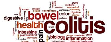 Ulcerativ proktitt er vanligvis den mildeste formen av ulcerøs kolitt. Ulceros Kolitt Rad Symptomer Diagnose Og Behandling