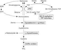 Image result for Homocystinuria