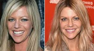 The Truth About Kaitlin Olson S Plastic Surgery Her Before After Pic