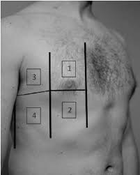 The interpretation of a chest film requires the understanding of basic principles. The Four Chest Areas Per Side Considered For Complete Lung Ultrasound Download Scientific Diagram