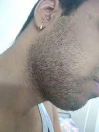 Only then will you know just how thick your beard could become. Hi What Do You Guys Think Of My Facial Hair Should I Let Them Grow And How Do Not Let Them Grow Dry Any Help Would Be Appreciated Malegrooming