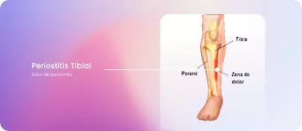 Image result for periostitis