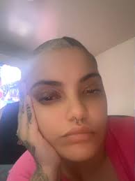 Be happy I’m cute my little patch is my stitches 😂