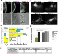 We refer to this special acceleration as the acceleration caused by gravity or simply the. Lamellipodin Tunes Cell Migration By Stabilizing Protrusions And Promoting Adhesion Formation Biorxiv