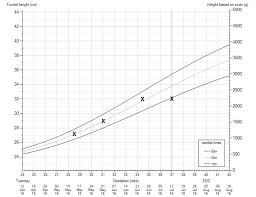 Fetal Growth Examples