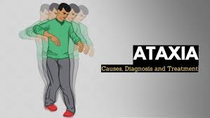 Image result for Ataxia