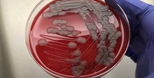 Image result for Anthrax