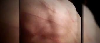 Bianco found that there was no crew present and. Marilyn Manson S Ex Esme Bianco Shares Disturbing Pic Of Welts On Back After Abusive Rocker Lashed Her With A Whip