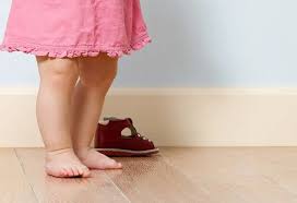 Image result for Out-toeing