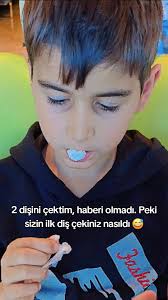 Yapay Zeka ile Diş Çekimi Deneyimi