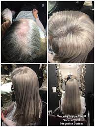 As a result, everything about these nearby locality hair salons can be taken from their websites and different applications like google maps and other ones on the internet on mobile phones only. Our Fabulous Mesh Volumizer Hair Integration System Hep With Alopecia Thinning Hair And Trichotillo Tape In Hair Extensions Hair Replacement Womens Hairstyles