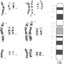 Image result for Delta F508