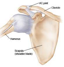 A tear of the rim below the middle of the glenoid socket that also involves the inferior glenohumeral ligament is called a bankart lesion. Ac Joint Sprain Adult