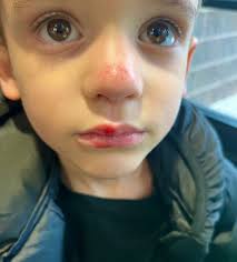 Bad wreck happening by the