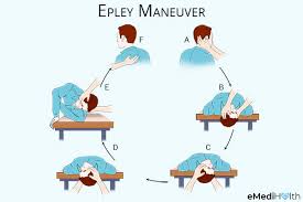 Jun 18, 2020 · the epley maneuver is a simple technique used to treat benign paroxysmal position vertigo (bppv), one of the most common types of vertigo. 7 Home Remedies Exercises To Stop Vertigo Emedihealth
