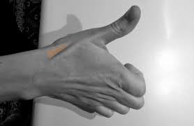 Palpable Anatomy The Anatomical Snuffbox Bone Broke The anatomical snuff box or snuffbox is a triangular deepening on the radial, dorsal aspect of the hand—at the level of the carpal bones, specifically, the scaphoid and trapezium bones forming the floor. the anatomical snuffbox