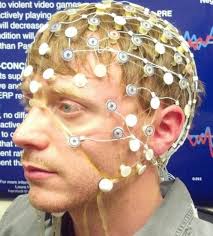 Purpose of Research Expected Results P300 Levels Methods