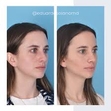 En cada procedimiento de Cirugía Plástica y Estética, el enfoque es la  excelencia. Las manos expertas, resultado de décadas de experiencia y  maestría en ciencias de la salud. ¡Descubre tu verdadera belleza! #