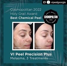 Kim Baier, CRNA (@barebeauty.crna) • Instagram photos and videos