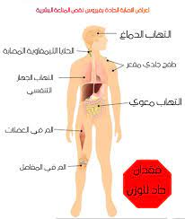 كيف تعرف اذا كنت مصاب بهذا المرض ام لا اعراض الايدز المميز