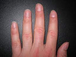 Nagel Anatomie Wikipedia