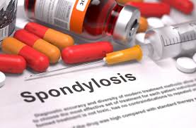 And other back pain is one of the most common medical problems, affecting 8 out of 10 people at some point during their lives. Icd 10 Codes For Documenting Spondylosis A Degenerative Condition