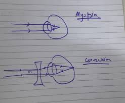 Read this article to learn its definition, examples and more. A Student Has Difficulty In Reading The Blackboard While Sitting In The Last Row What Could Be Defect Brainly In