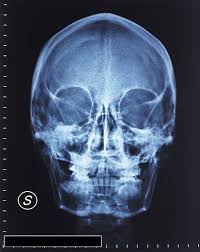 Image result for Skull XRay