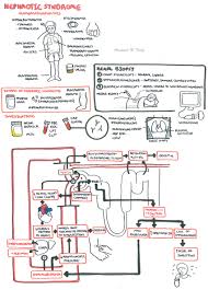 Nephrotic Syndrome Armando Hasudungan