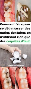 Epingle Sur Sante