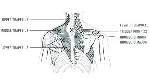 The muscles of the back that work together to support the spine, help keep the the back muscles can be three types. Open Your Front Side To Relieve Pain In Your Neck And Back